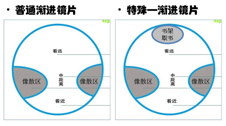 漸進(jìn)多焦鏡的原理與應(yīng)用，3個(gè)光區(qū)，看遠(yuǎn)近只需一副
